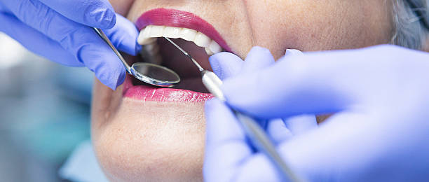 Best Emergency Treatment for Dental Infections or Abscesses in Plant City, FL